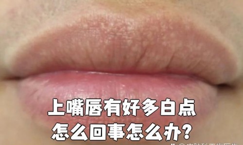 知柏地黄丸和维生素b1可以同吃吗-知柏地黄丸和维生素b1可以同吃吗、仲景知柏地黄丸维生素D -知柏地黄丸和多维元素同服功效网